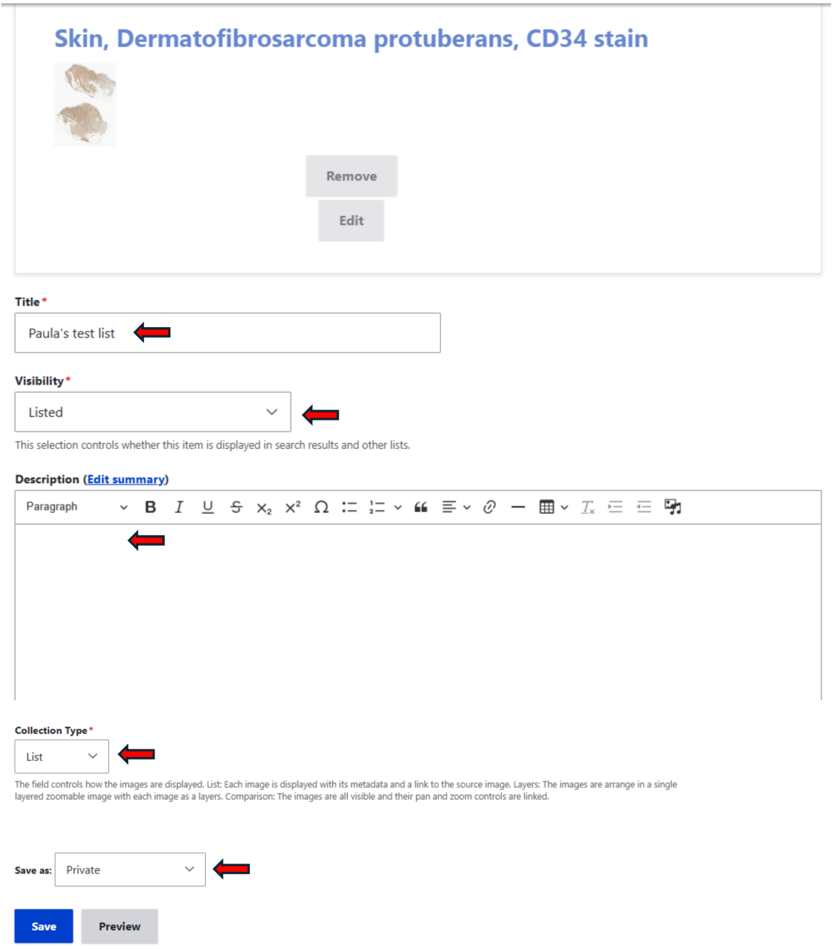 Screenshot of the create list form highlighting the title, visibility, description, collection type and access type fields.